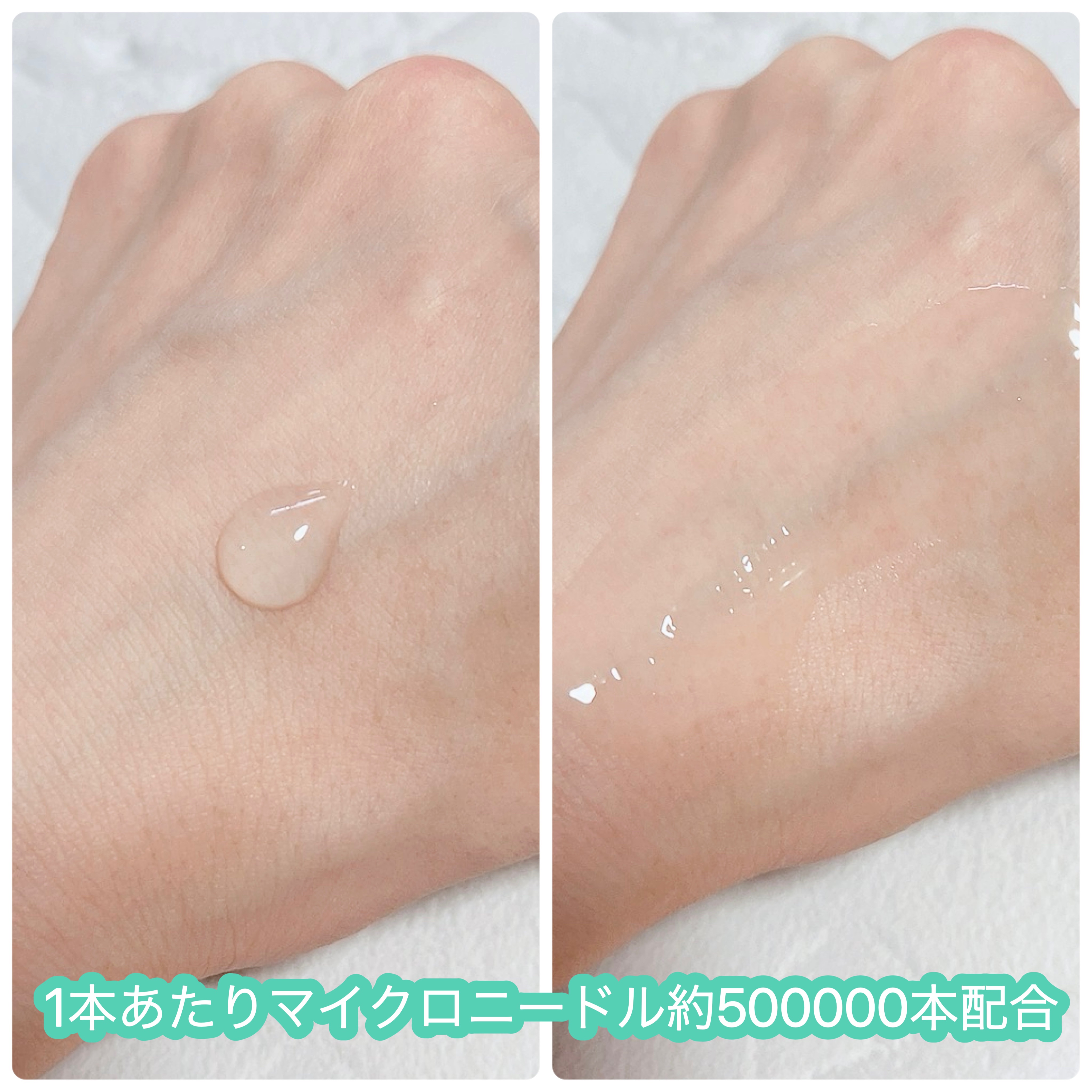 リードルリッチ パワーニードルセラム/REEDLE RICH/美容液を使ったクチコミ（3枚目）