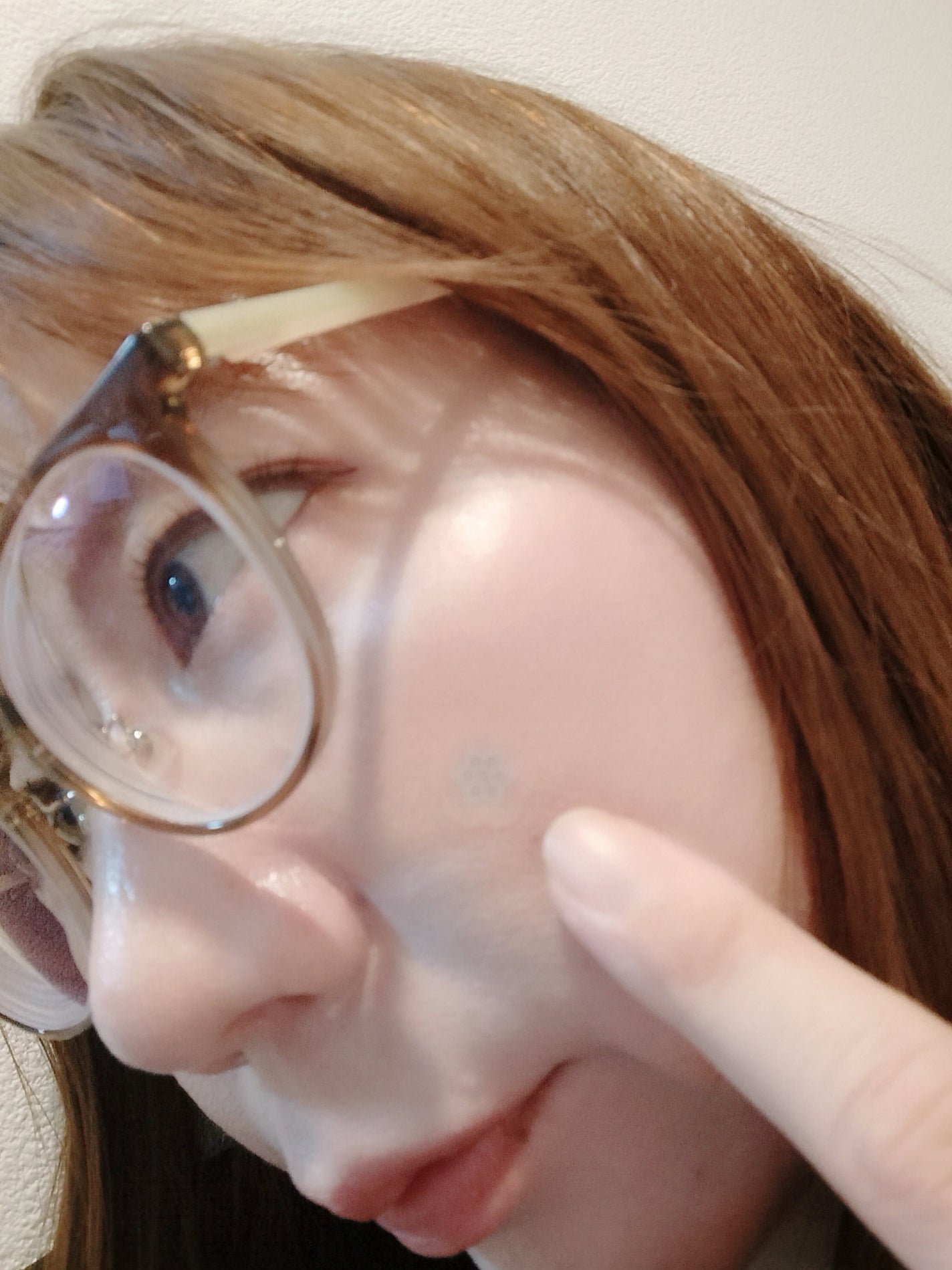 ACマグネシウムパッチ ミニ/スノーツープラス/にきびパッチを使ったクチコミ(3枚目)