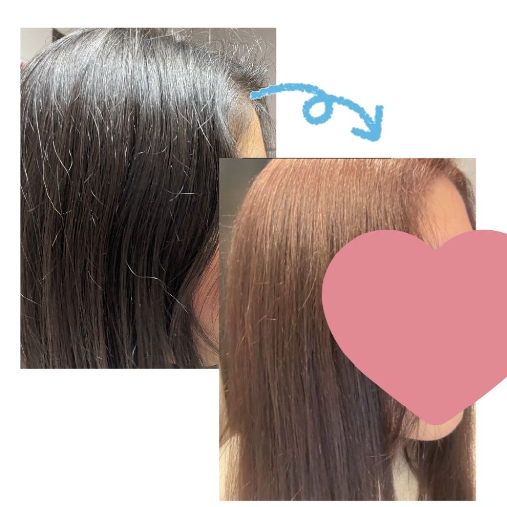 オリジナル ピュアスキンジェリー/ヴァセリン/ボディクリームを使ったクチコミ（1枚目）