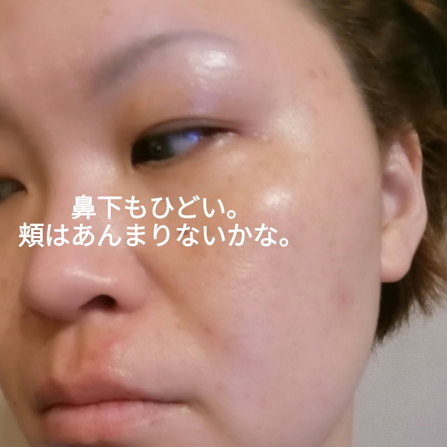 マジックティーツリーオイル/ブラン/フェイスオイルを使ったクチコミ(4枚目)