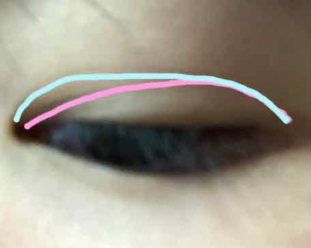 ふたえテープ 目立たず肌になじむ絆創膏タイプ/DAISO/二重まぶた用アイテムを使ったクチコミ(2枚目)