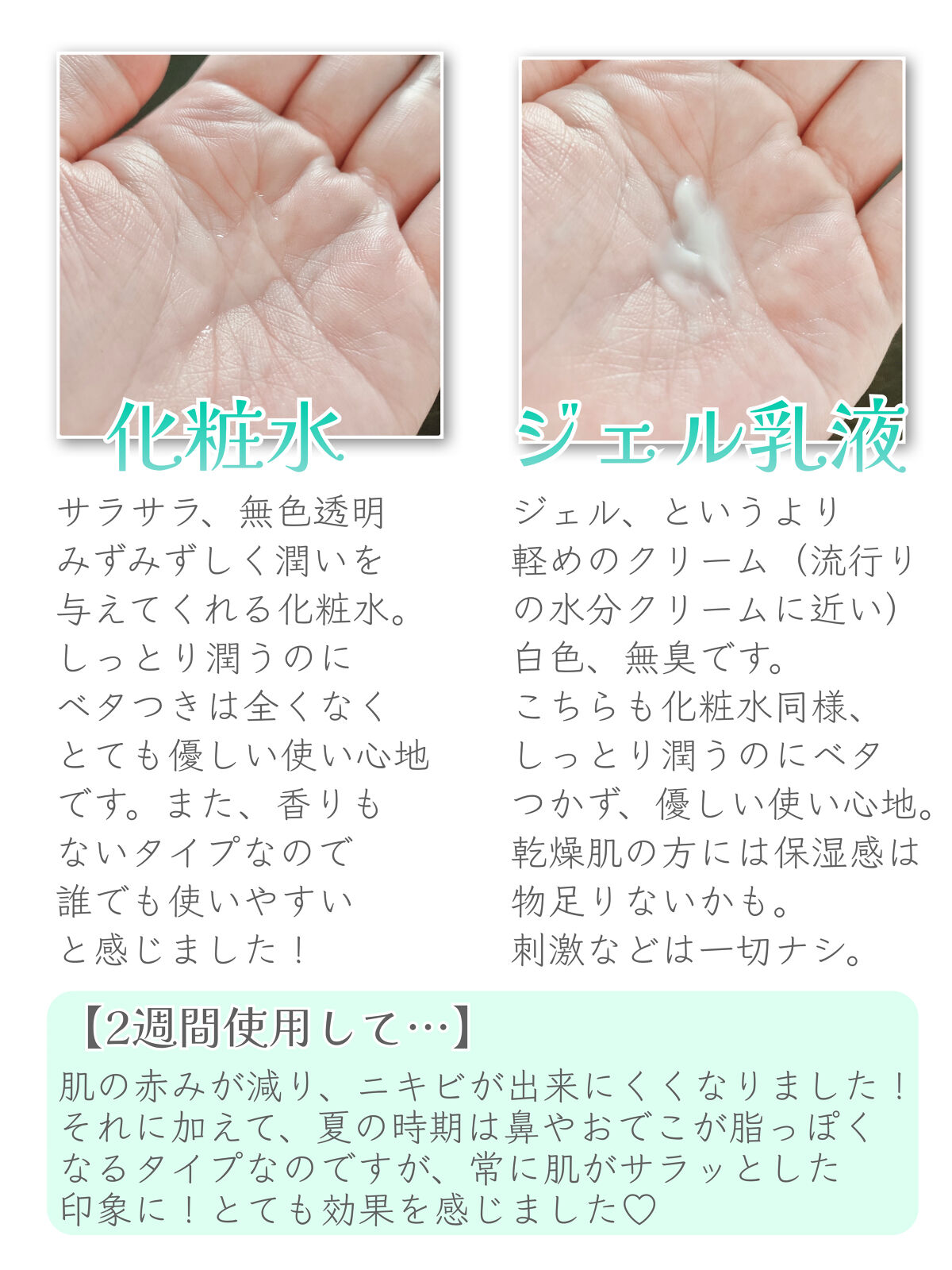 アクネケア ジェル乳液　＜医薬部外品＞/ファンケル/乳液を使ったクチコミ（2枚目）