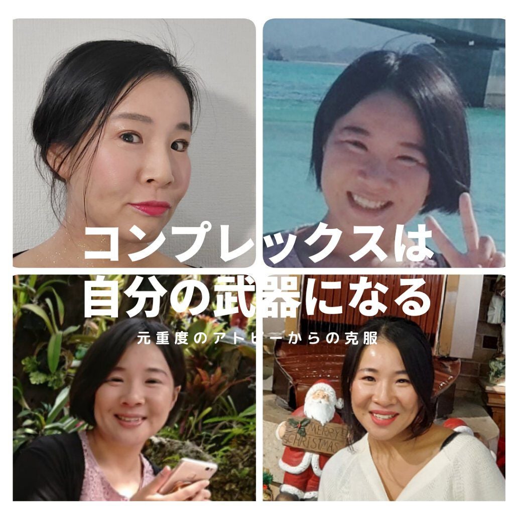 美肌カウンセラー💆肌悩みを解決し見る世界を変える on LIPS 「【本気で変わりたい🧙】私は【アトピー】と言う最高のコンプレック..」(1枚目)