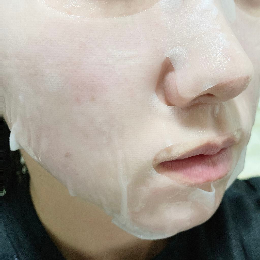 レッドB・Cスムージングクリーム/Dr.G/フェイスクリームを使ったクチコミ(8枚目)