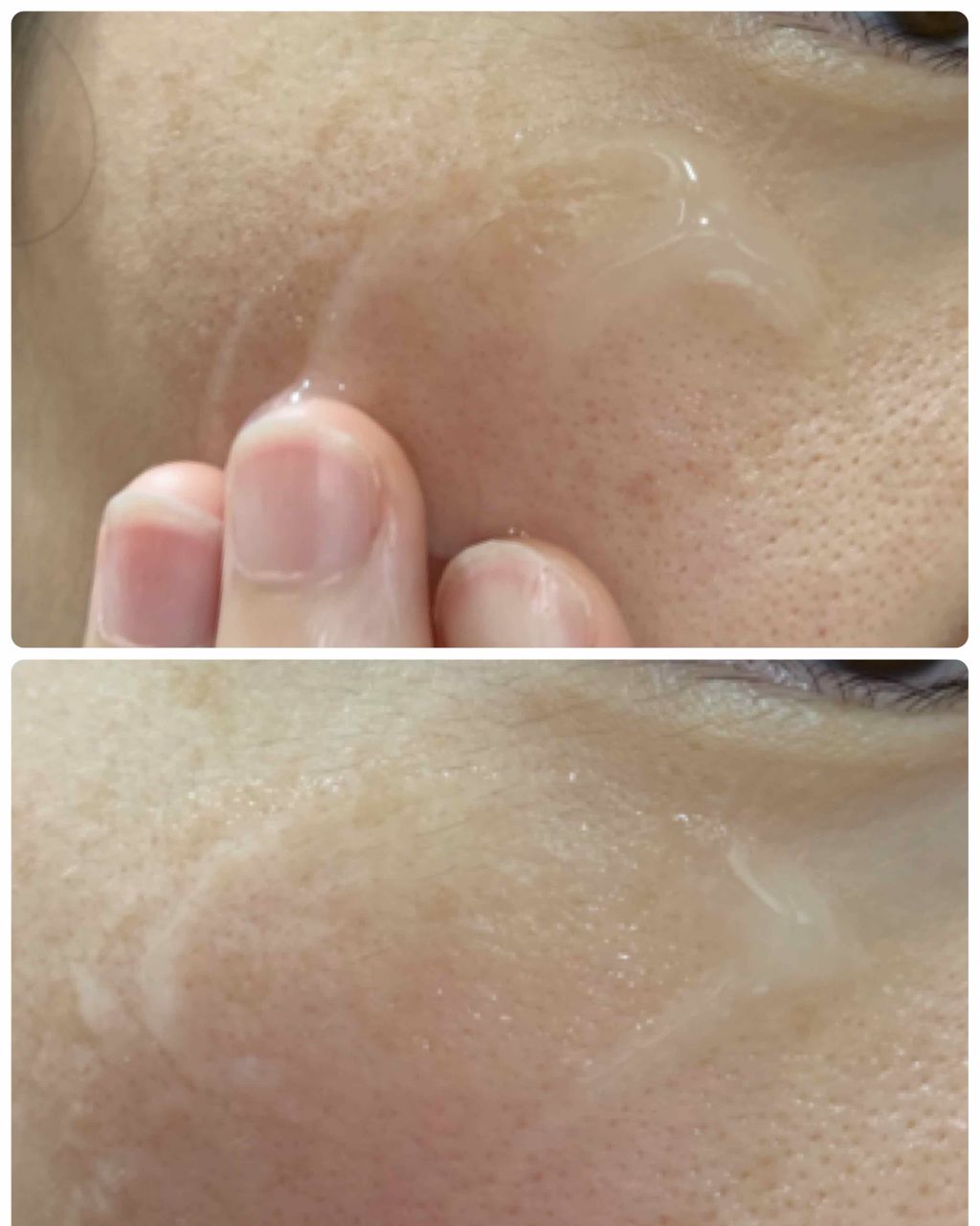 メディプラスゲル/メディプラス/オールインワン化粧品を使ったクチコミ（3枚目）