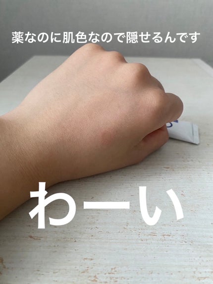 エスカメル(医薬品)/佐藤製薬/その他を使ったクチコミ(6枚目)