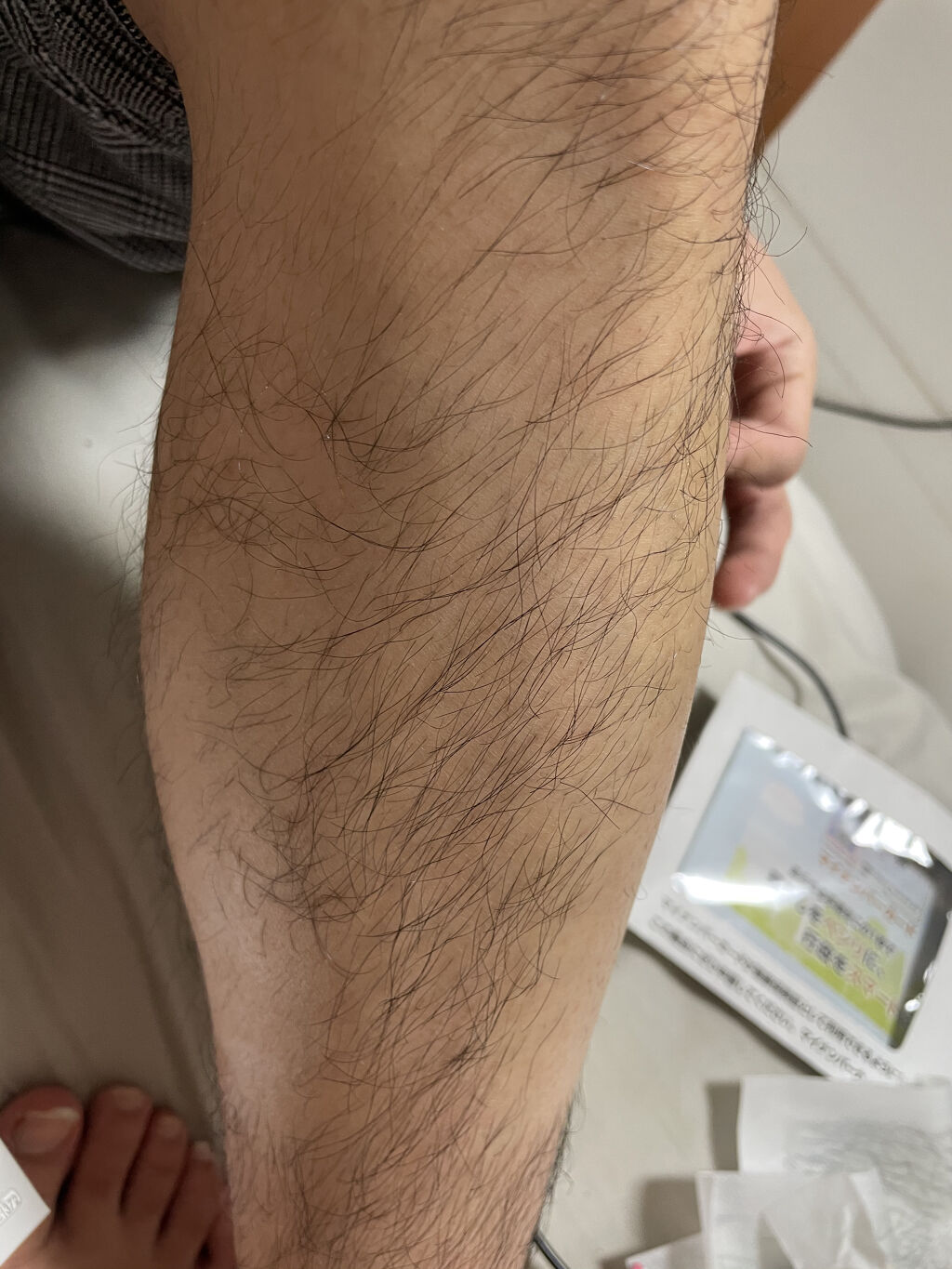 脱毛 ワックスシート/DAISO/除毛クリームを使ったクチコミ（2枚目）