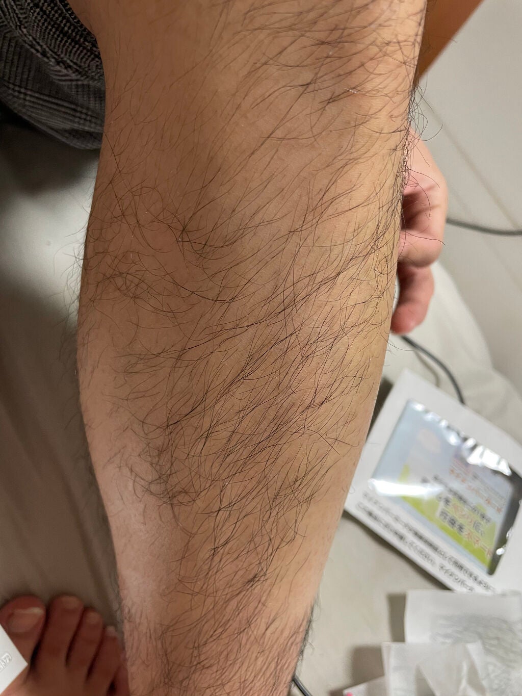脱毛 ワックスシート/DAISO/除毛クリームを使ったクチコミ(2枚目)