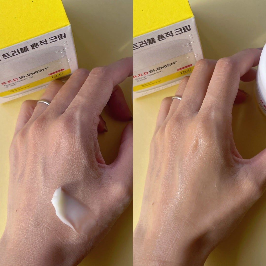 レッドブレミッシュ リペアスージングクリーム/Dr.G/フェイスクリームを使ったクチコミ(3枚目)