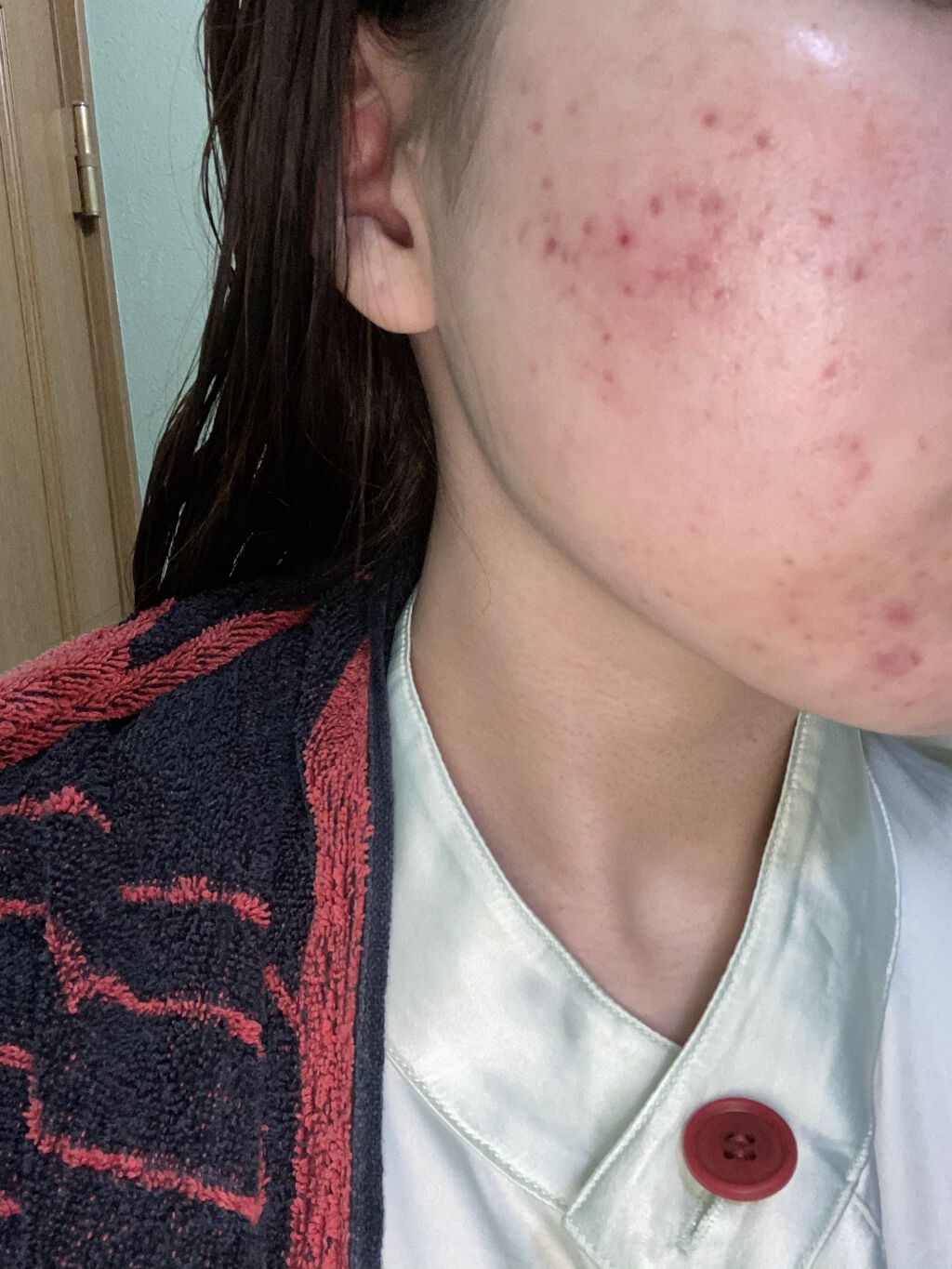 ホワイトニング エッセンス/アルージェ/美容液を使ったクチコミ（2枚目）