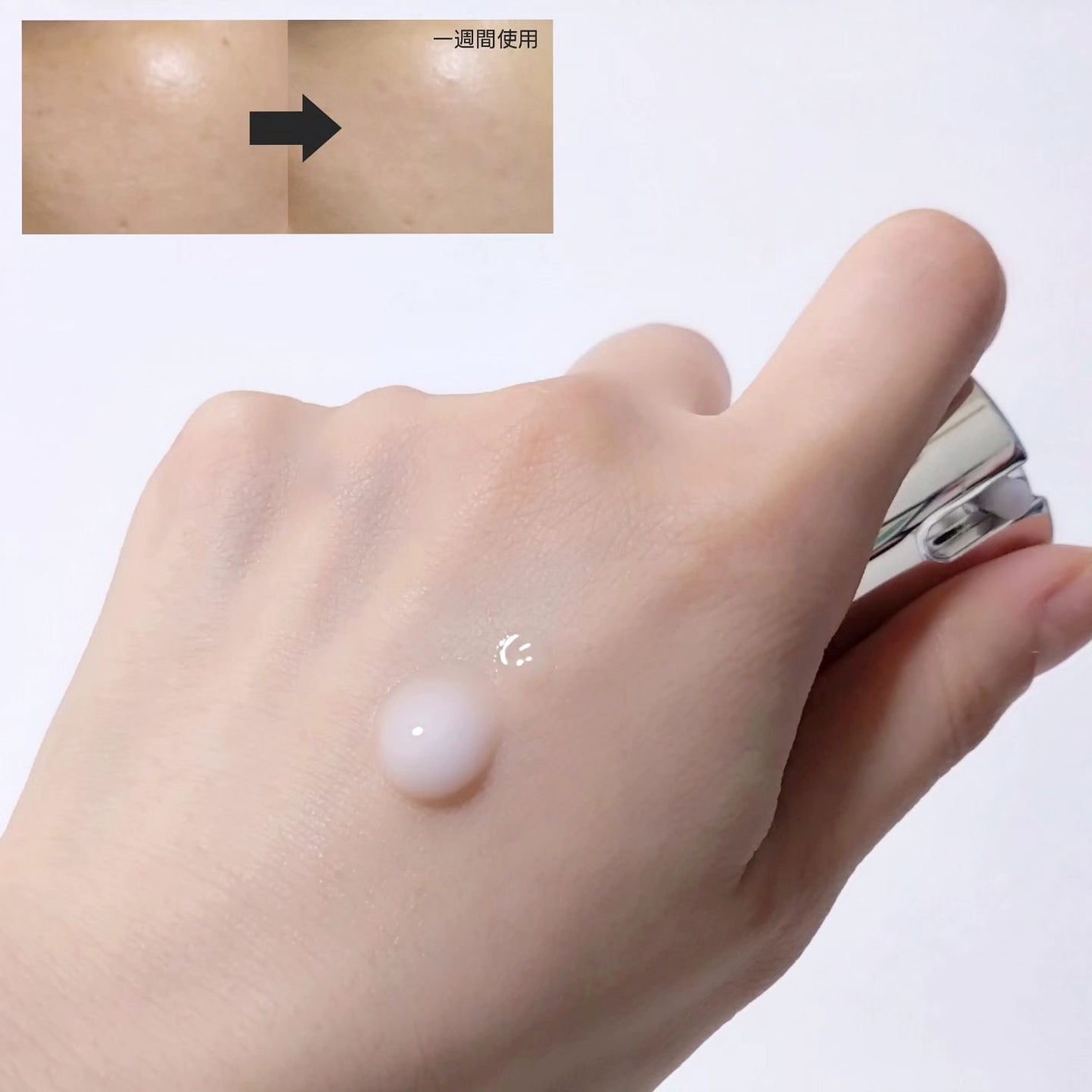 リードルショット300/VT/美容液を使ったクチコミ(3枚目)