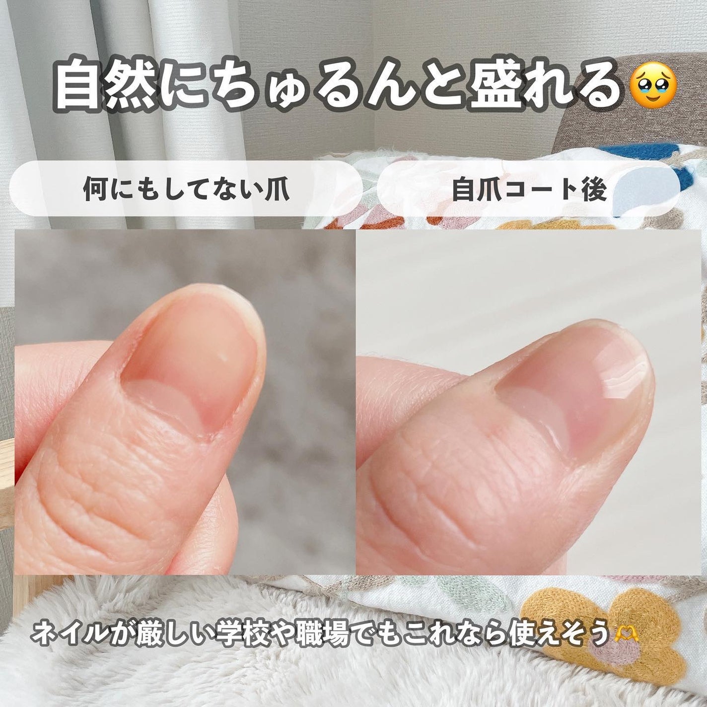 自爪コート/ネイリスト/オールインワンネイルを使ったクチコミ(2枚目)