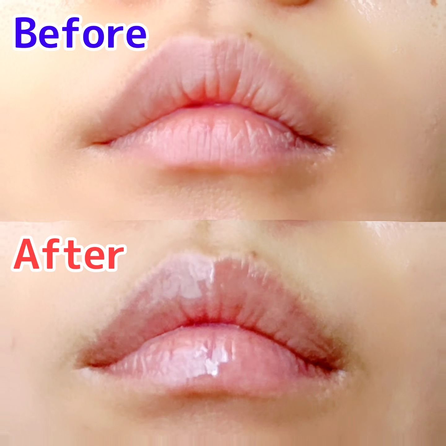 MWAH NEEDLE LIPS/MWAH/リッププランパーを使ったクチコミ（3枚目）