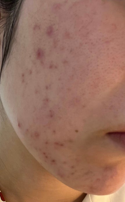 を使ったクチコミ(2枚目)