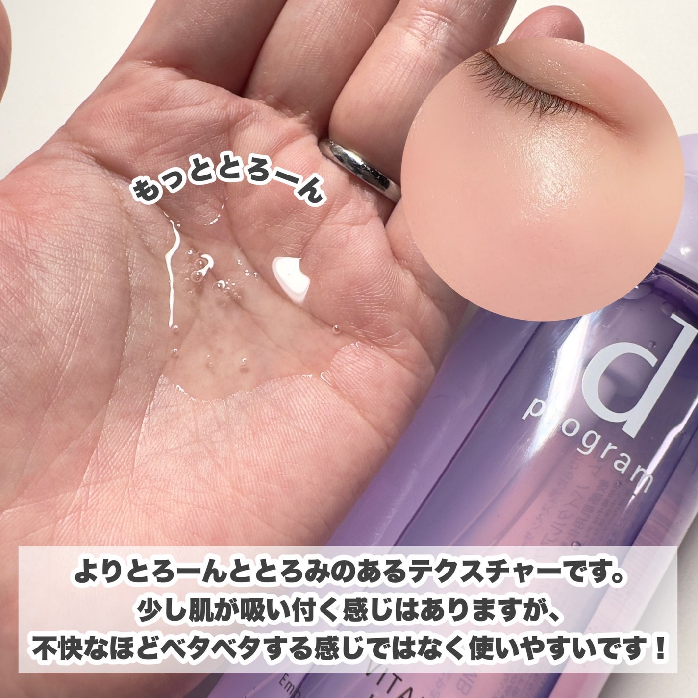 モイストケア ローション MB/d プログラム/化粧水を使ったクチコミ(8枚目)