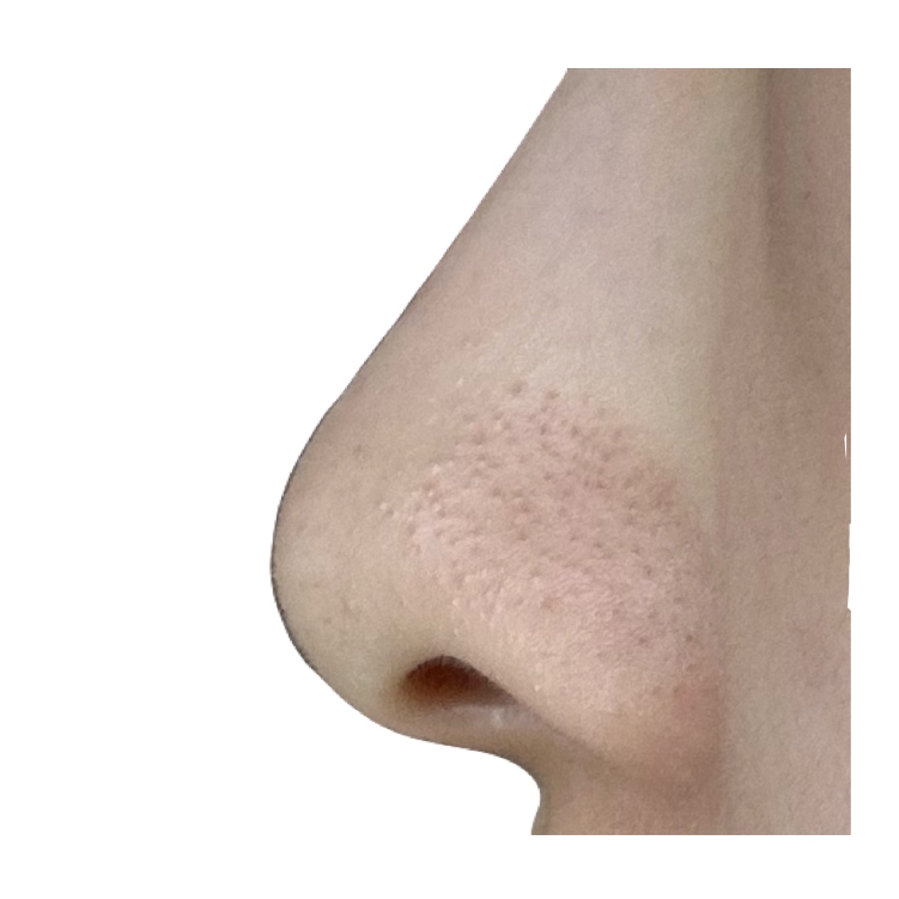 パーフェクトワンフォーカス スムースクレンジングバーム ディープブラック クロミ 限定デザイン（75g）/PERFECT ONE  FOCUS/クレンジングバームを使ったクチコミ（3枚目）