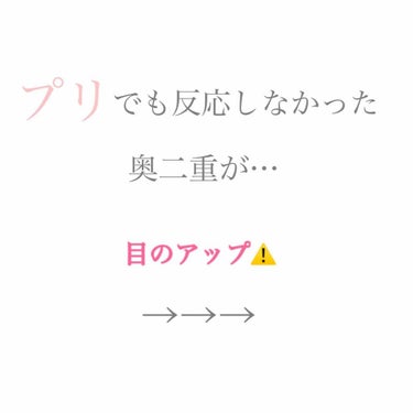 約3ヶ月間アイプチをして
プリでも認識してくれる二重に👀

アイプチのやり方🙊
・奥二重の線にアイプチの液を塗る。
（私は特に奥二重の癖が強い目頭、目尻に塗ってました。）

・乾かして奥二重の線にプッシ