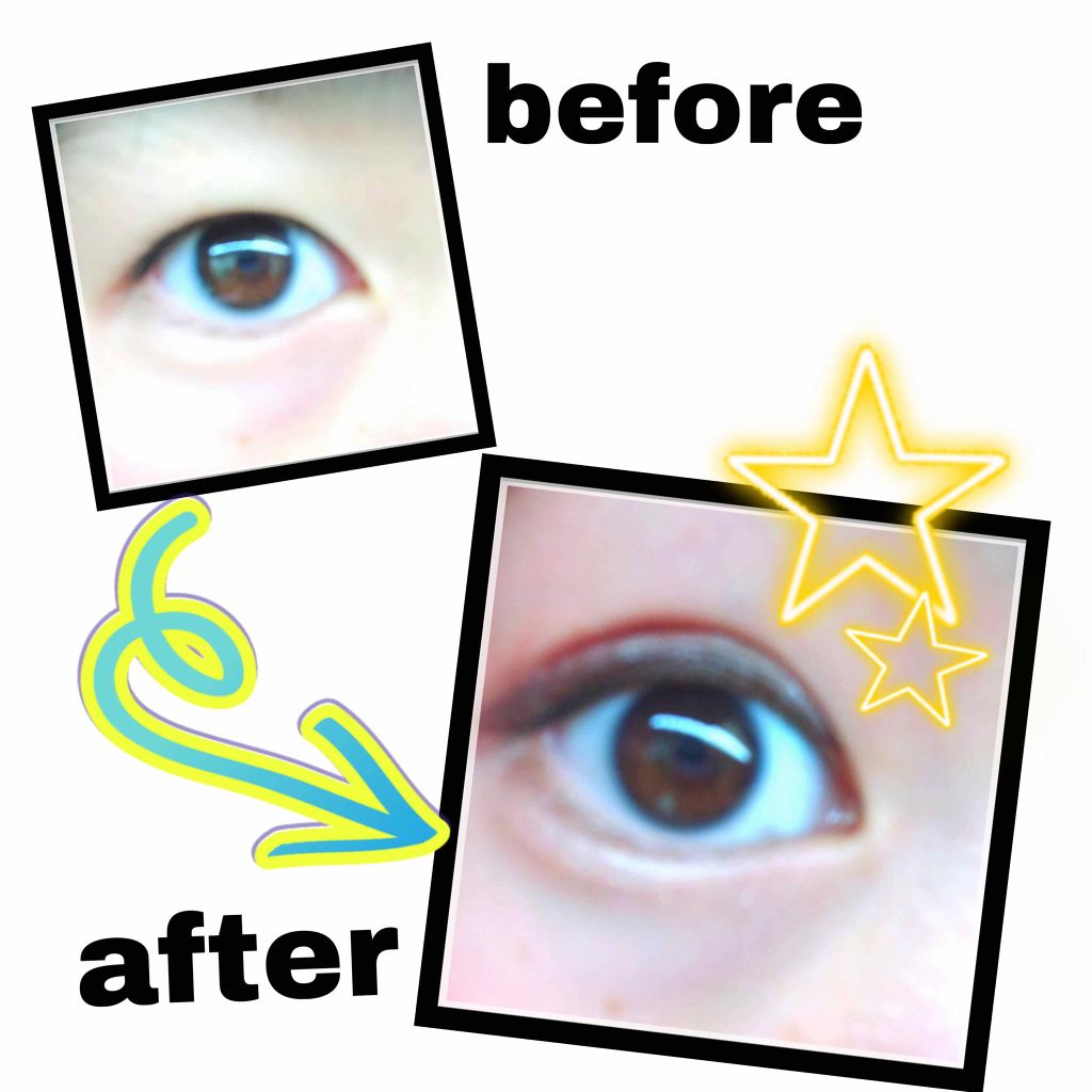 【旧品】オリシキ アイリッドスキンフィルム/D-UP/二重まぶた用アイテムを使ったクチコミ(2枚目)