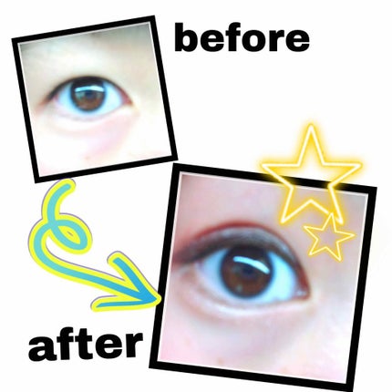 【旧品】オリシキ アイリッドスキンフィルム/D-UP/二重まぶた用アイテムを使ったクチコミ(2枚目)