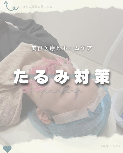 ディレイア ゼル/Direia/美顔器・マッサージを使ったクチコミ(1枚目)