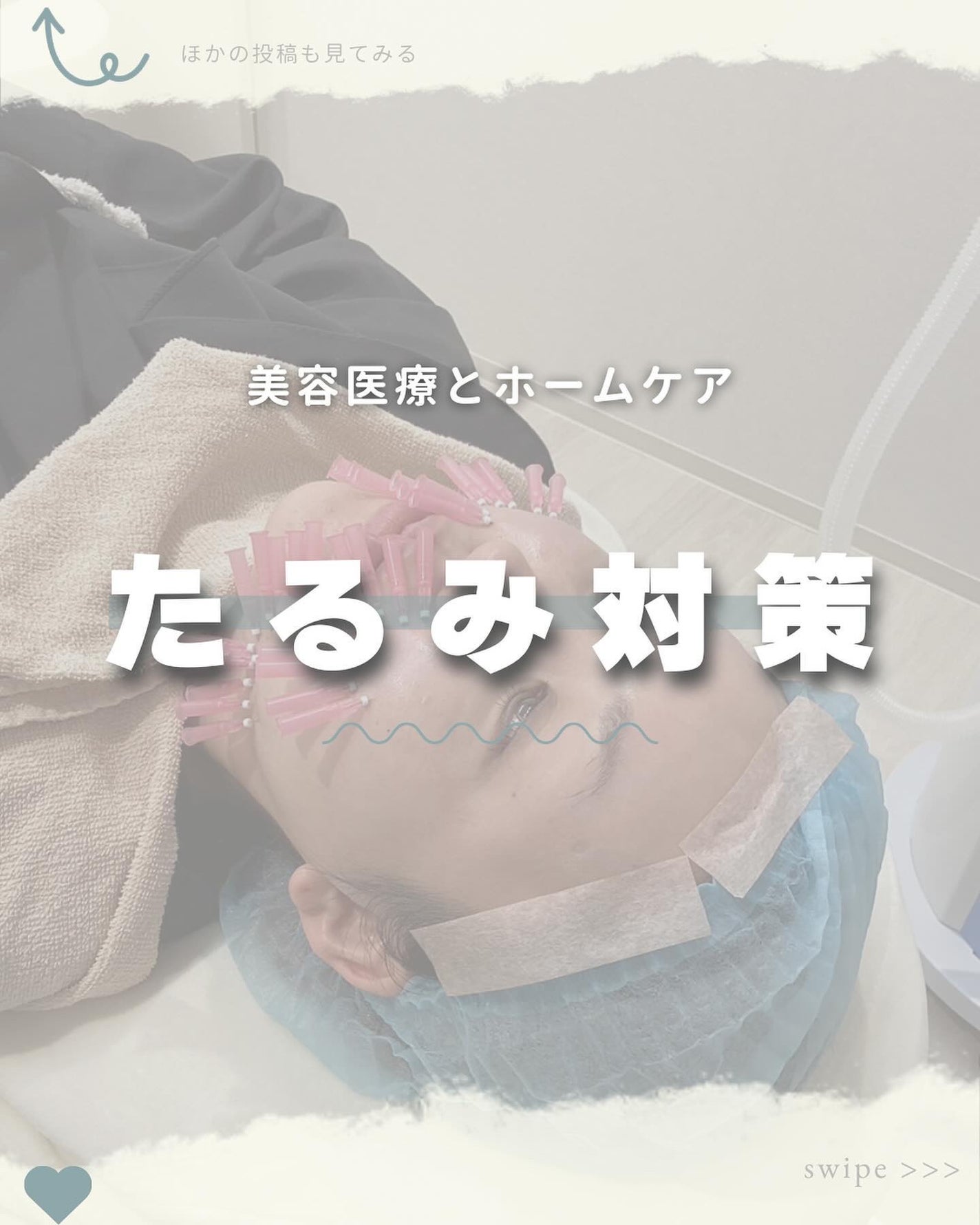 試してみた】ディレイア ゼル Direiaのリアルな口コミ・レビュー 試してみた】ディレイア ゼル Direiaのリアルな口コミ・レビュー