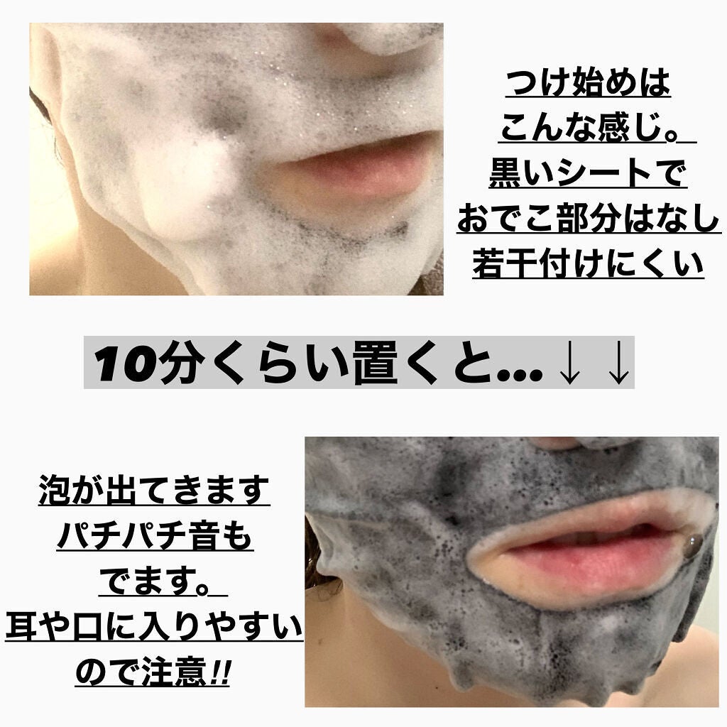 炭酸バブルシート/MEDIHEAL/シートマスク・パックを使ったクチコミ(3枚目)