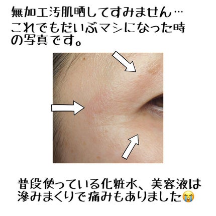 金のプラセンタもっちり白肌濃シワトール/ホワイトラベル/アイケア・アイクリームを使ったクチコミ(2枚目)