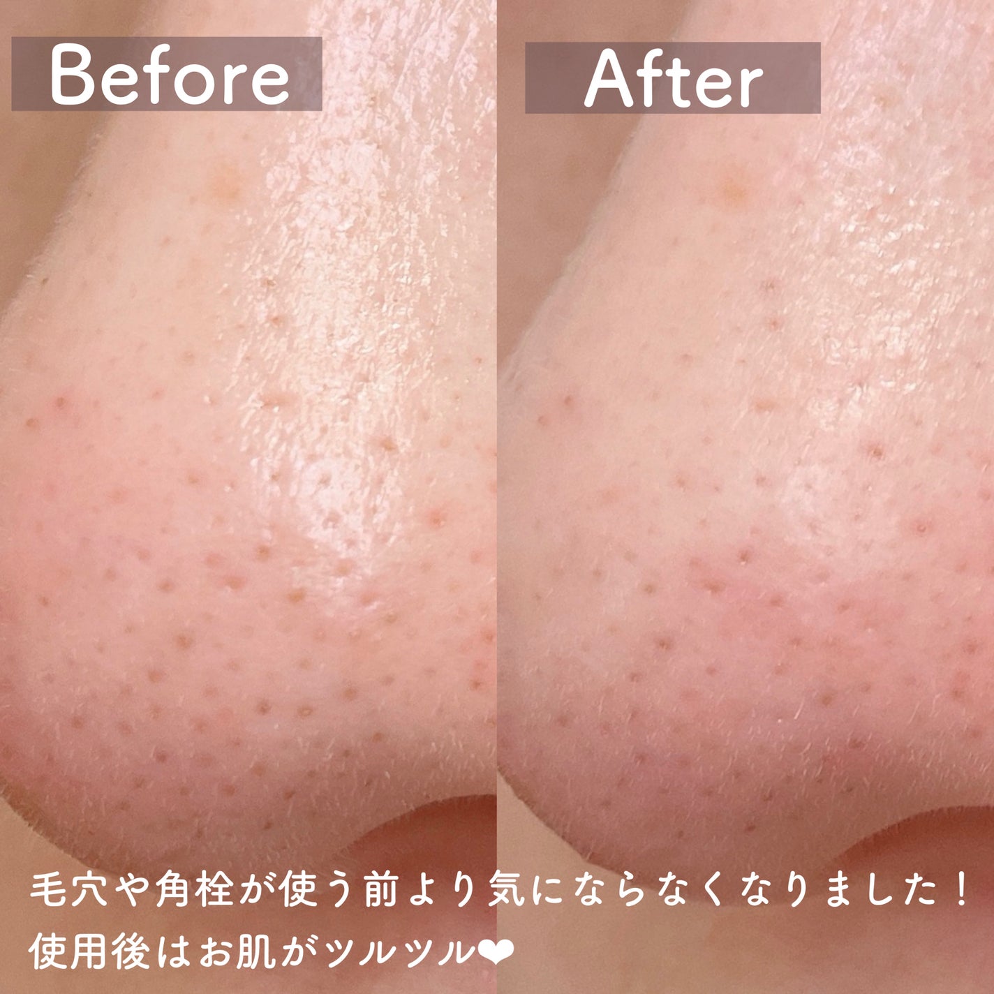 メデイケア ポアレス クレンジングジェル/Dr.Reve/クレンジングジェルを使ったクチコミ(3枚目)