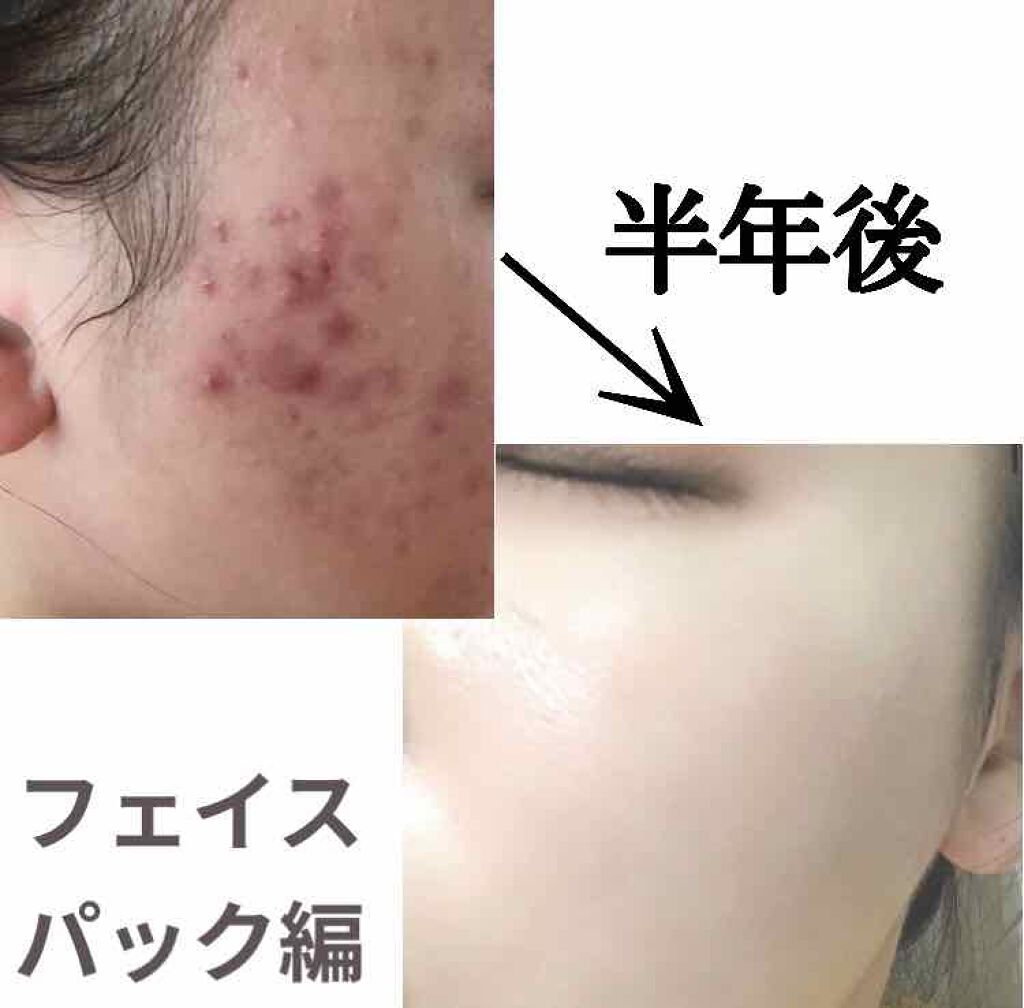 ハリウッド オーキッド ピックアップマスク/ハリウッド/洗い流すパック・マスクを使ったクチコミ（1枚目）