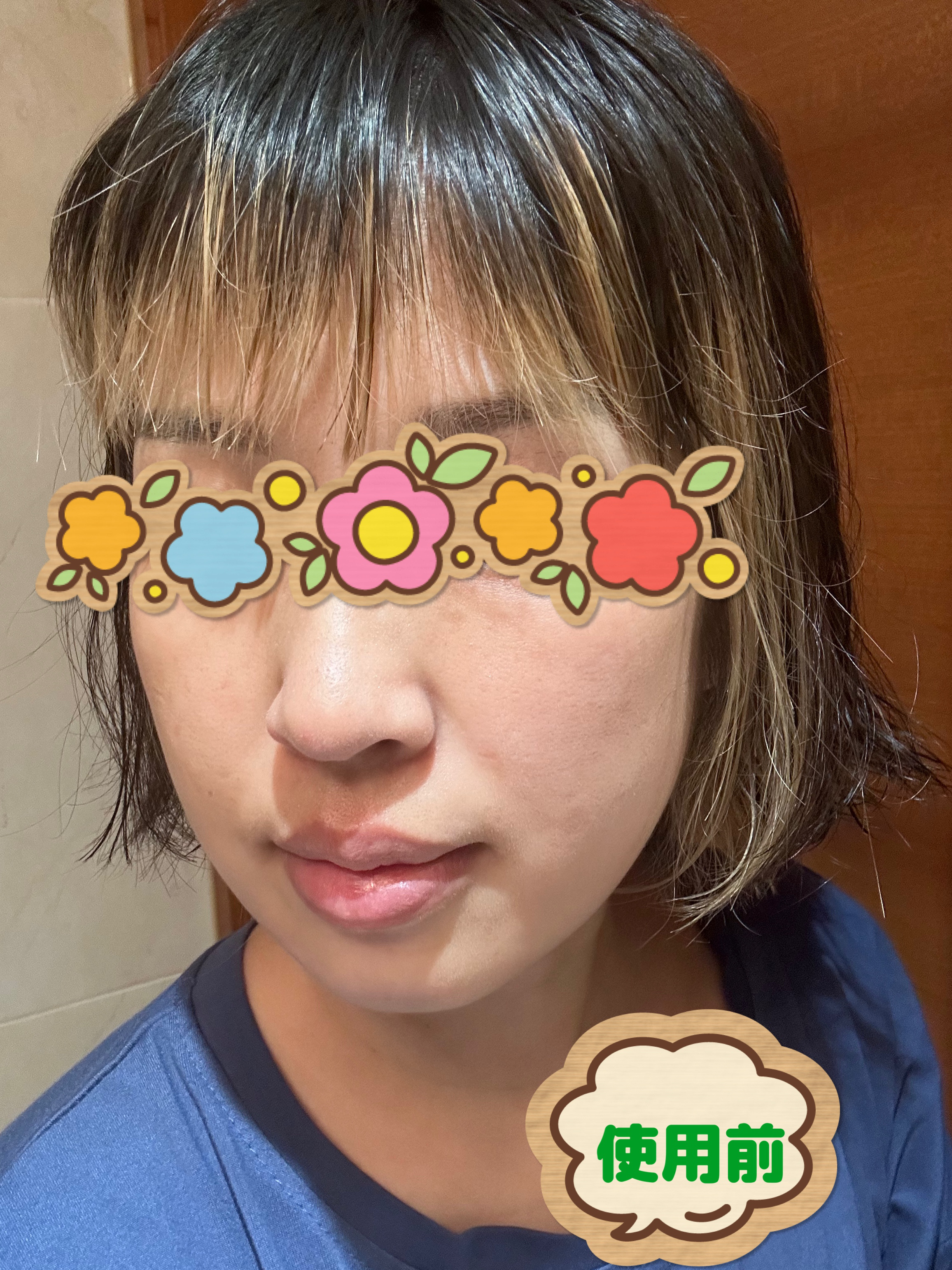 マデカクリームタイムリバース/センテリアン24/フェイスクリームを使ったクチコミ（3枚目）