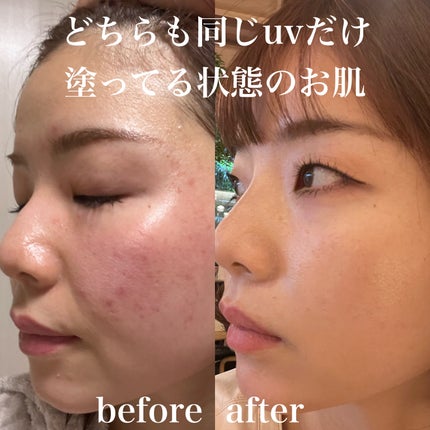 モイストシャインミスト/Lekarka/ミスト状化粧水を使ったクチコミ(2枚目)