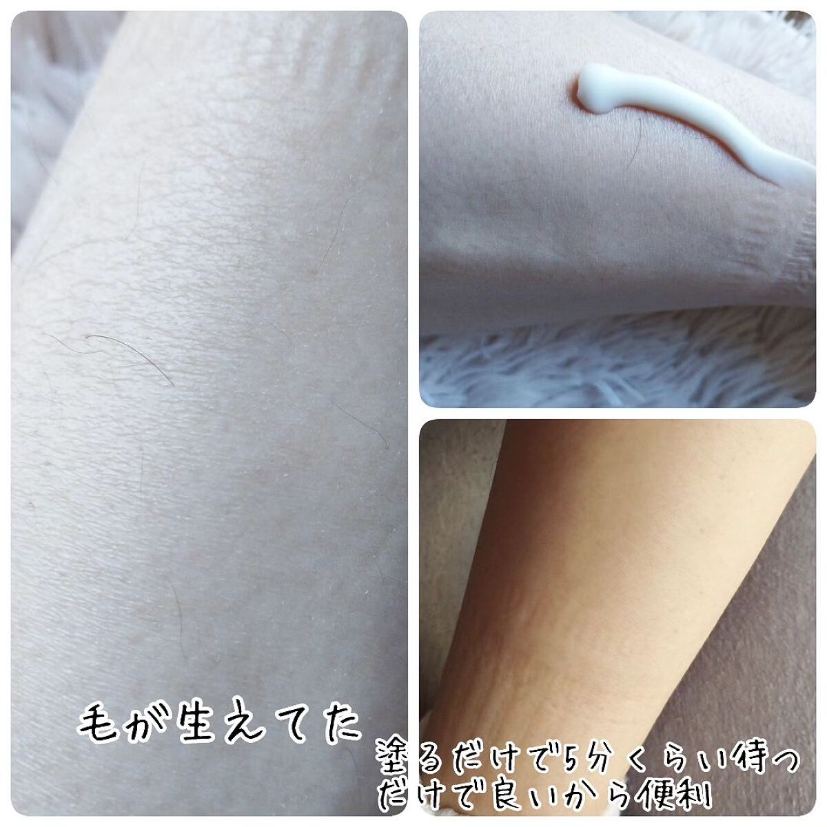 薬用Zリムーバー/コスメ二スト/除毛クリームを使ったクチコミ（2枚目）