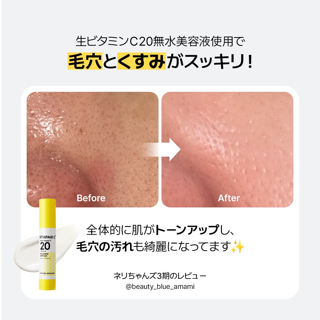 ネイチャーリパブリック公式アカウント on LIPS 「くすみ・毛穴が気になる方必見!!生ビタミンC20無水美容液を3..」(1枚目)