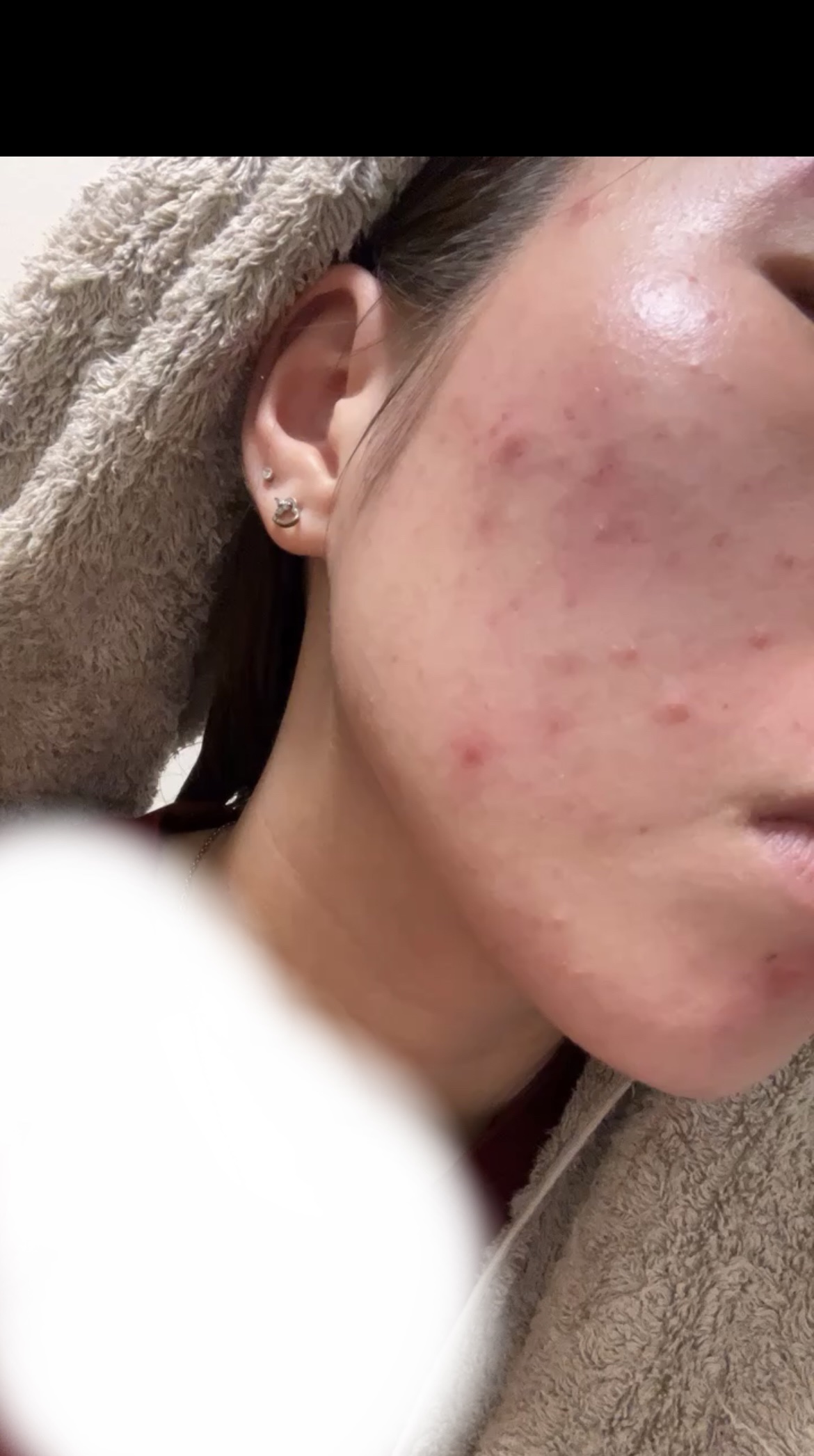 チョコラBBプラス (医薬品)/チョコラBB/その他を使ったクチコミ（2枚目）