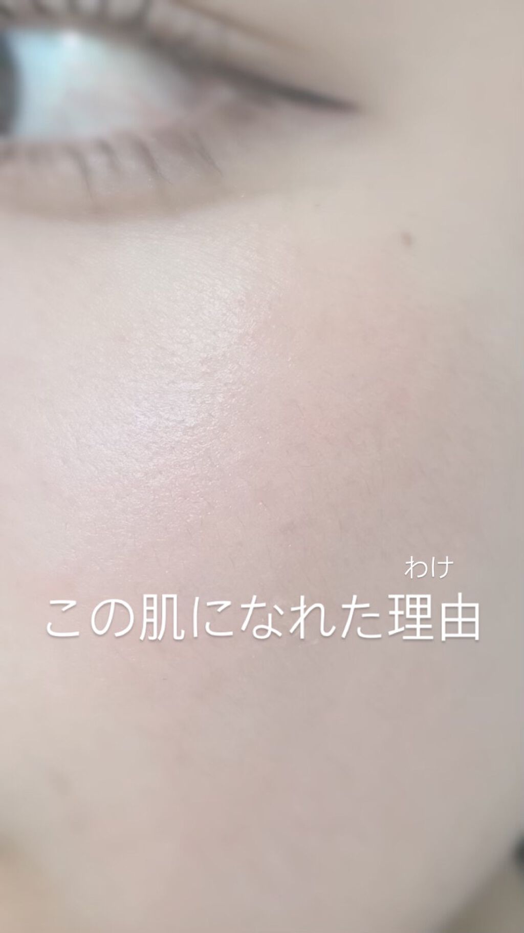 薬用しみ対策 美白化粧水/メラノCC/化粧水を使ったクチコミ（1枚目）