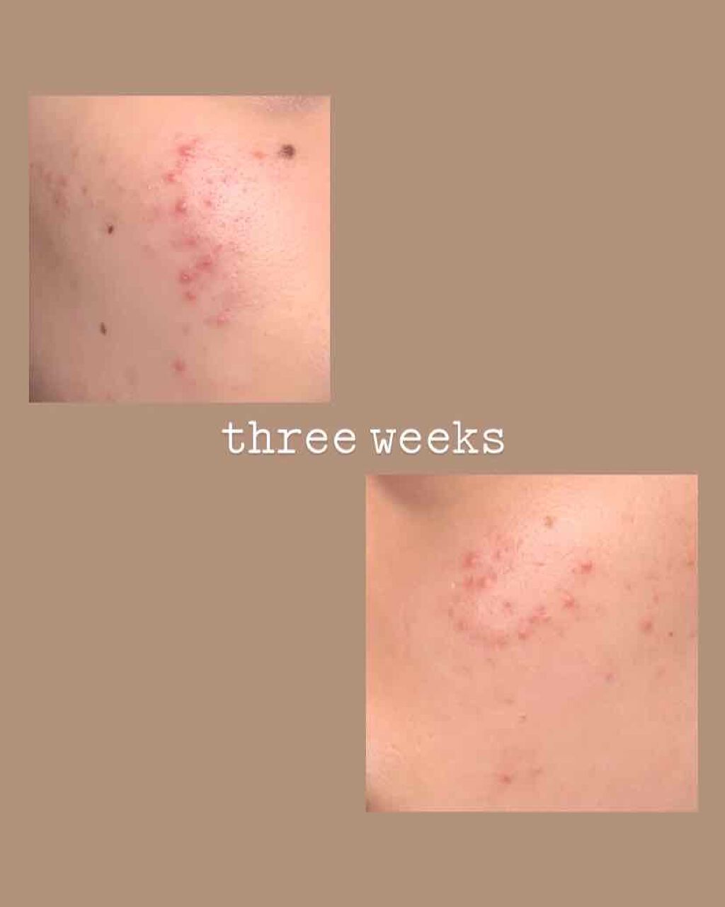 ðŠ on LIPS ãç®èç§ã§è²°ã£ãè¬äœ¿çšéå§..ãïŒ2æç®ïŒ