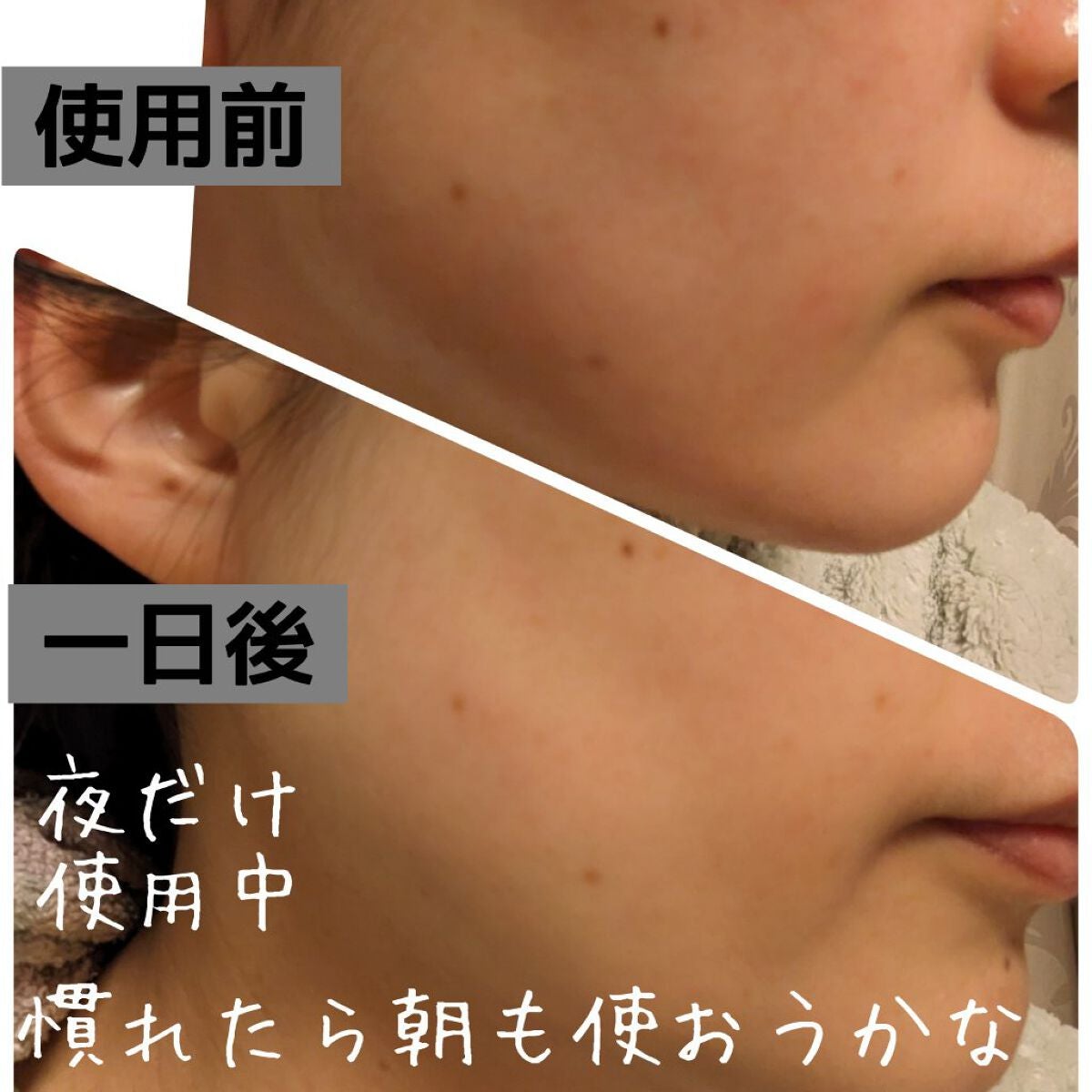 CICA クリーム/VT/フェイスクリームを使ったクチコミ(5枚目)