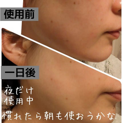 CICA クリーム/VT/フェイスクリームを使ったクチコミ(5枚目)