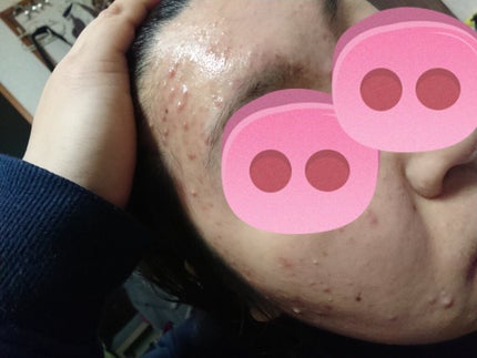 スチーマー ナノケア EH-SA37/Panasonic/美顔器・マッサージを使ったクチコミ(6枚目)