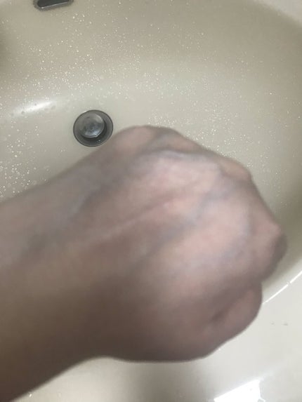 ナチュラルクッションピーリング/アカラン/ピーリングを使ったクチコミ(2枚目)