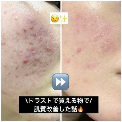 菊正宗 日本酒の化粧水 高保湿/菊正宗/化粧水を使ったクチコミ(1枚目)