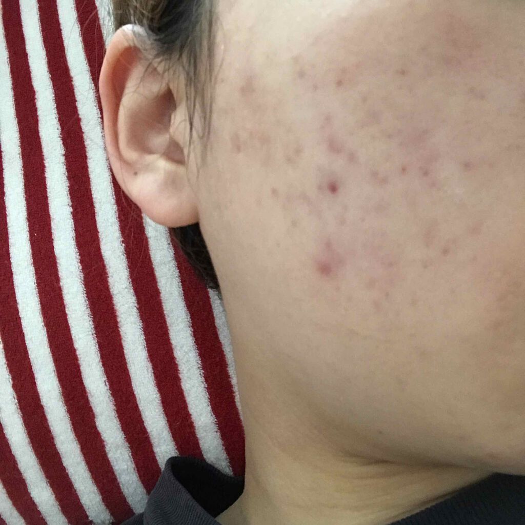 𥺠on LIPS ãççäžã«1å倧ããã®åºæ¥ããã©ããããã以å€ã¯ãã·ã«ãªã£ãŠãïŒ..ãïŒ3æç®ïŒ