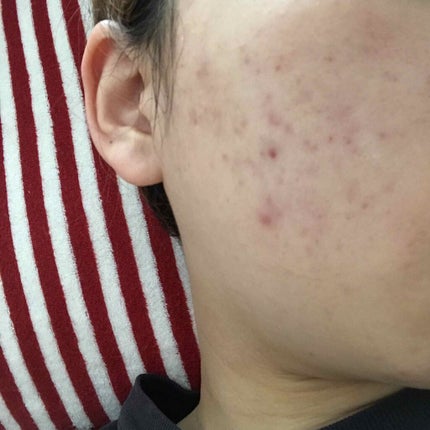 𥺠on LIPS ãççäžã«1å倧ããã®åºæ¥ããã©ããããã以å€ã¯ãã·ã«ãªã£ãŠãïŒ..ãïŒ3æç®ïŒ