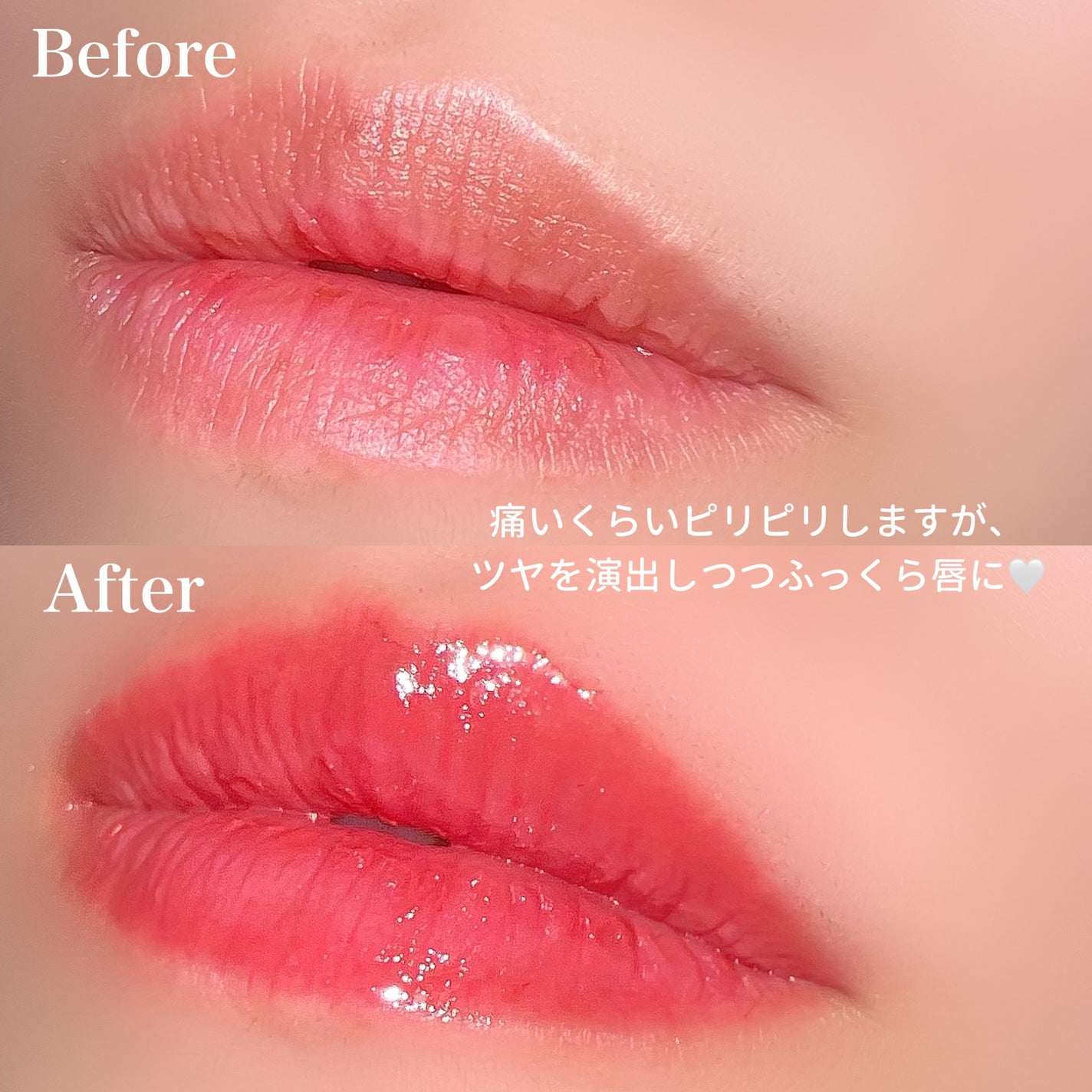 ドトムリッププラスプランパー/keybo/リッププランパーを使ったクチコミ(4枚目)