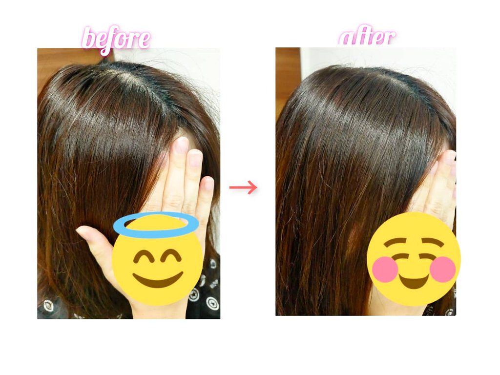 メディカルスカルプスパエッセンス/ティアレラプラス/頭皮ローションを使ったクチコミ(4枚目)