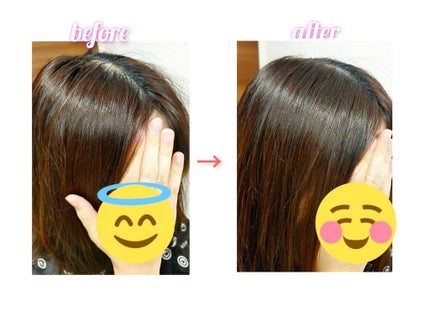 メディカルスカルプスパエッセンス/ティアレラプラス/頭皮ローションを使ったクチコミ(4枚目)