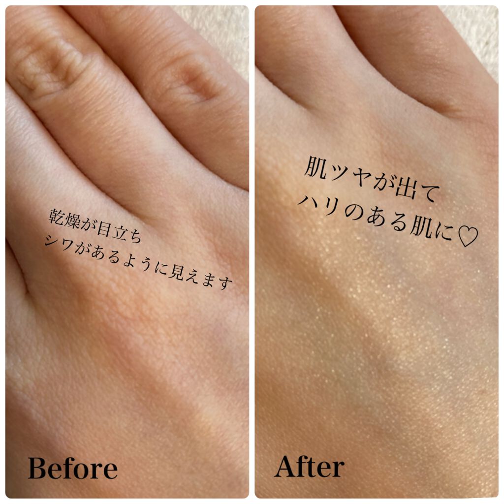 セラムショット N/PHOEBE BEAUTY UP/美容液を使ったクチコミ(3枚目)