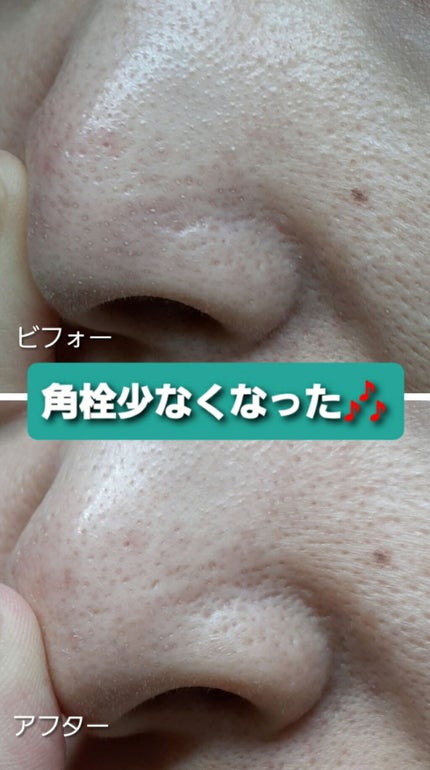 グリーン クレイ/マンデイムーン/その他洗顔料を使ったクチコミ(1枚目)