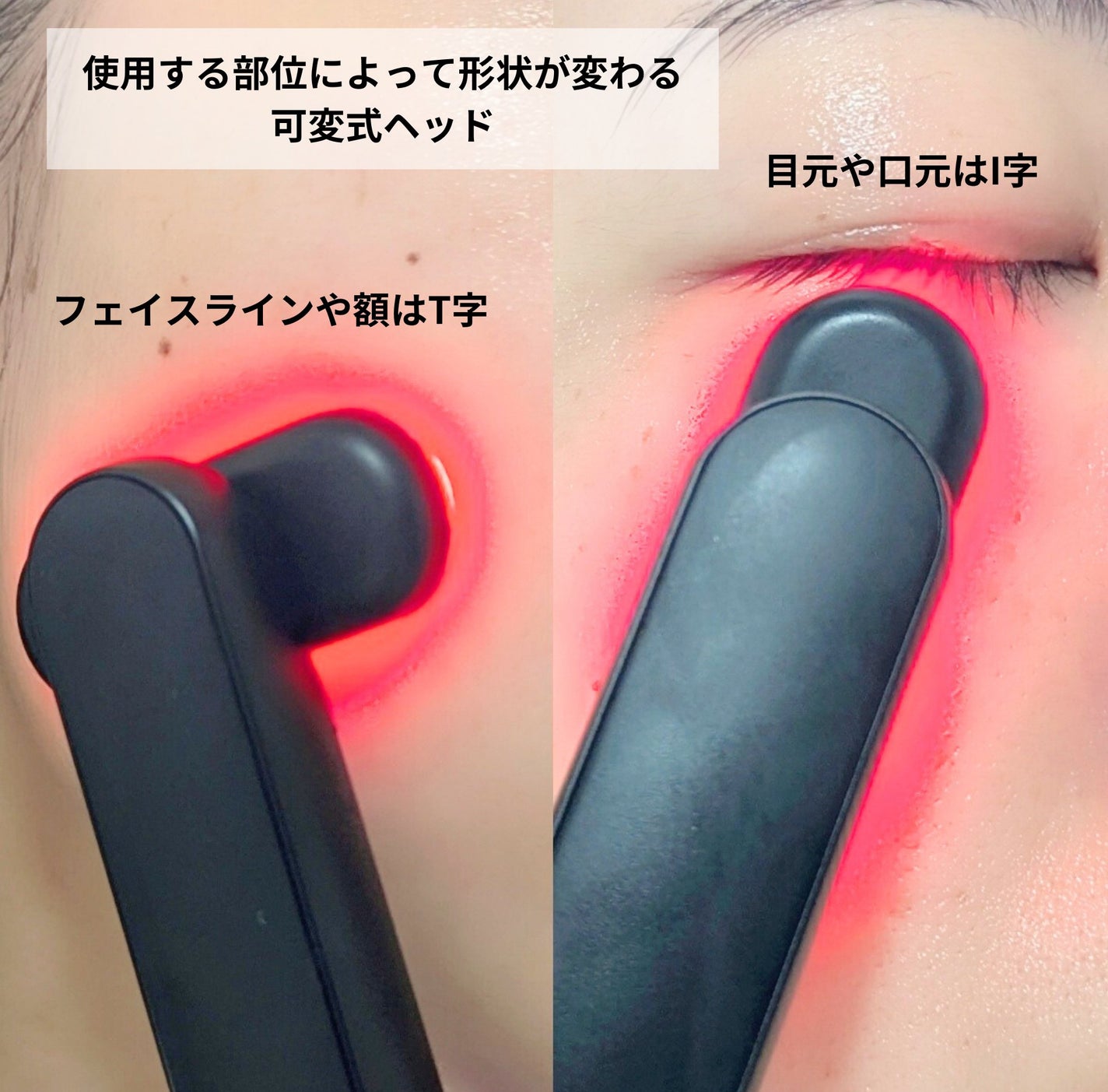 ディズム EMS EER メディスキンケアデバイス/DISM/美顔器・マッサージを使ったクチコミ(4枚目)