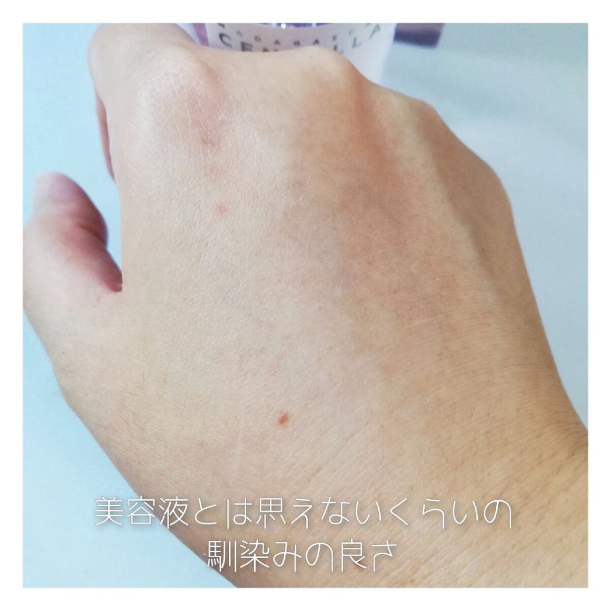 ポアマイジング フラッシュ アンプル/SKIN1004/美容液を使ったクチコミ(4枚目)